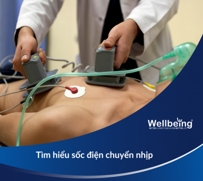 Tìm hiểu sốc điện chuyển nhịp | Wellbeing