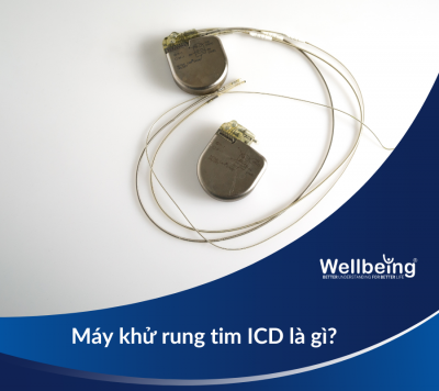 Máy khử rung tim ICD là gì?| Wellbeing