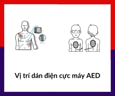 Vị trí dán điện cực máy AED: dán sao cho đúng?| Wellbeing 