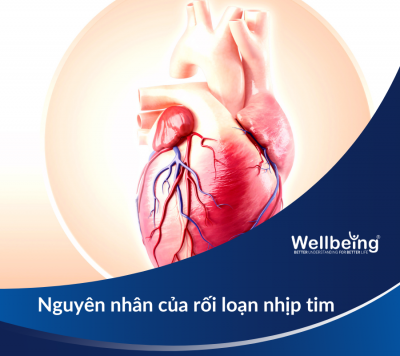 Nguyên nhân của rối loạn nhịp tim: Hiểu để bảo vệ sức khỏe tim mạch