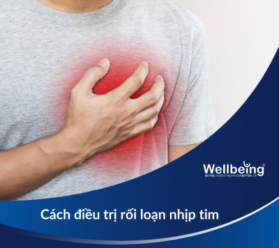 Cách Điều Trị Rối Loạn Nhịp Tim