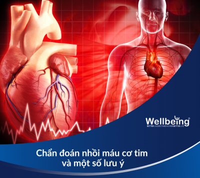 Chẩn đoán nhồi máu cơ tim và một số lưu ý