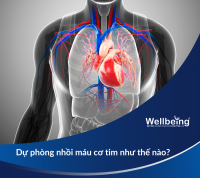 Dự phòng nhồi máu cơ tim như thế nào?