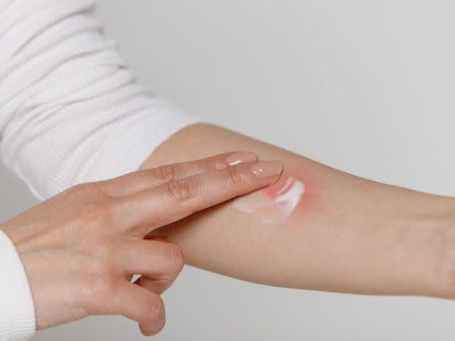 sai-lam-pho-bien-khi-gap-tai-nan-lao-dong